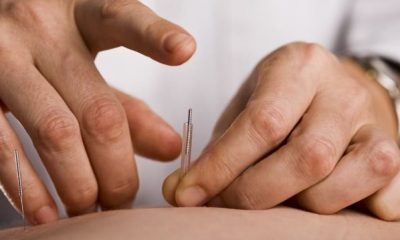 How to Find a Top-Quality Acupuncture Clinic