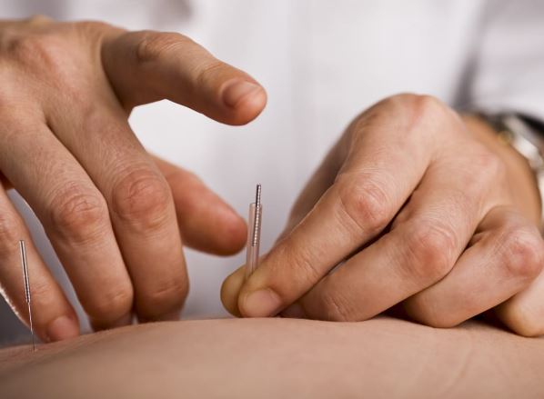 How to Find a Top-Quality Acupuncture Clinic