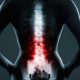 How to Get Ready Physically for Your Back Surgery