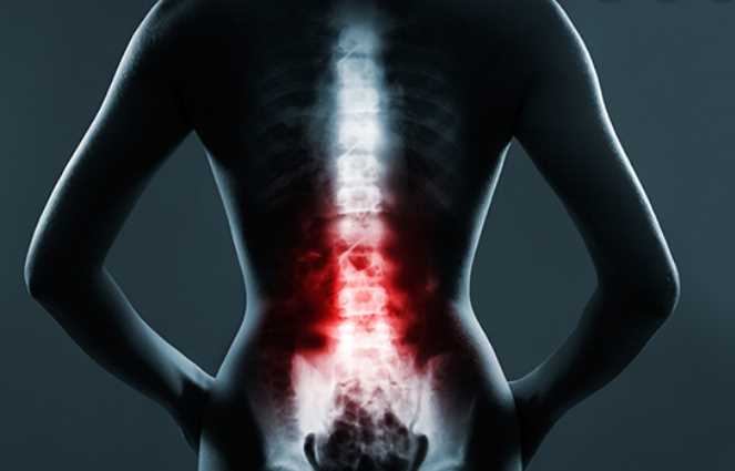 How to Get Ready Physically for Your Back Surgery