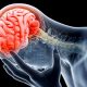 Brain Injuries; Forms and its effects: