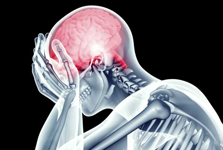 Headache vs Migraine