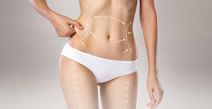 4 Main Differences Between Liposuction And Vaser Liposuction