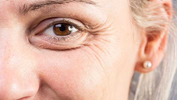 Use a laser treatment for wrinkles