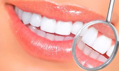 Dental Implants vs. Veneers