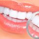 Dental Implants vs. Veneers