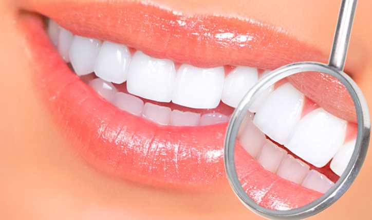 Dental Implants vs. Veneers